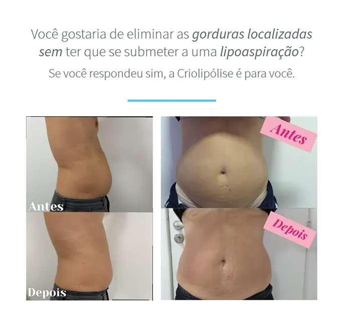 1resultado