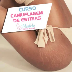Curso Camuflagem de Estrias, Manchas e Cicatrizes