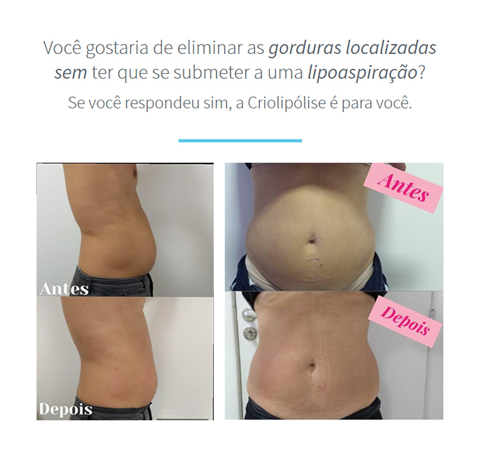 1resultado